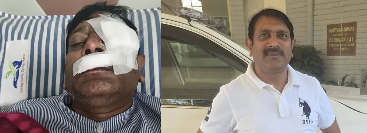 पार्षद पति हमला कांड में नया मोड़ : 'मंथली' के आरोपों से गरमाई सियासत, आरोपी सुपरवाइजर का पलटवार