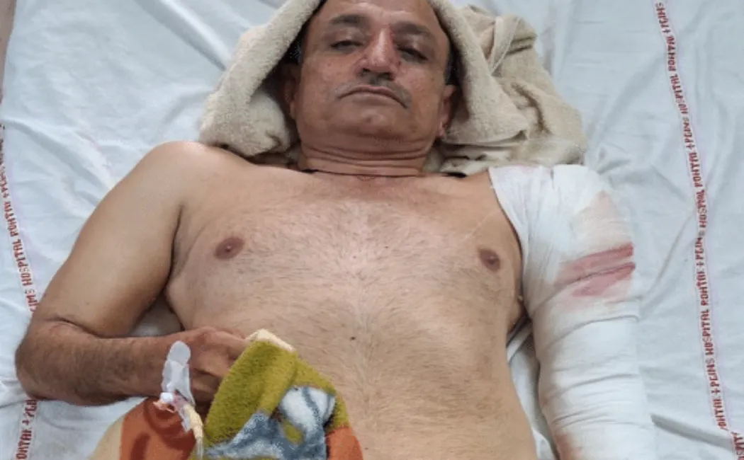 सरकारी 'बाबू' बना अपराधी : जमीनी विवाद में दिल्ली पुलिस से रिटायर्ड 'पिता' को मारी गोली, हालत गंभीर